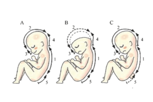 Những điều cần biết về dị tật bẩm sinh ở thai nhi